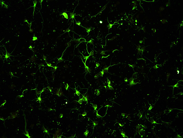 貴州師范大學(xué)采購明美大靶面高靈敏度冷CCD應(yīng)用于生命科學(xué)研究