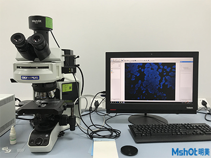 明美CCD顯微鏡相機助力廈門弘愛醫(yī)院乳腺癌腫瘤切片觀察
