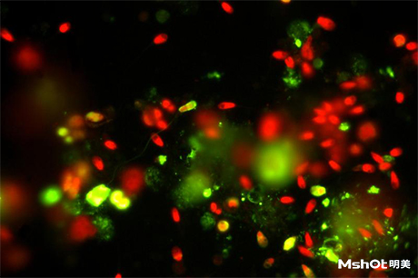 明美熒光模塊助力國外企業(yè)FITC PI 熒光染色切片觀察
