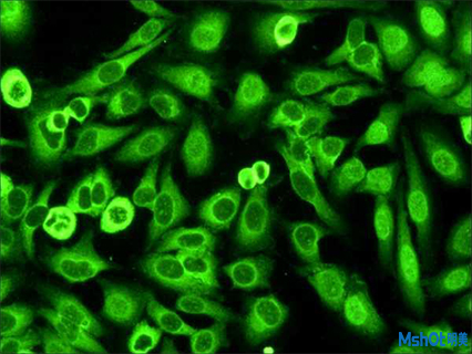 明美CCD顯微鏡相機搭配徠卡顯微鏡用于熒光標記