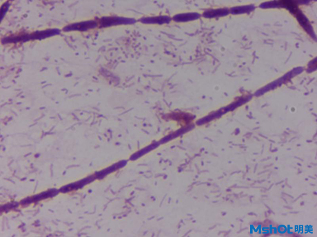 明美生物顯微鏡應用于污水凈化及環(huán)保領域