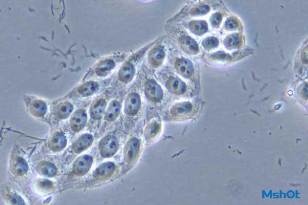 明美倒置顯微鏡應用于細胞培養(yǎng)觀察