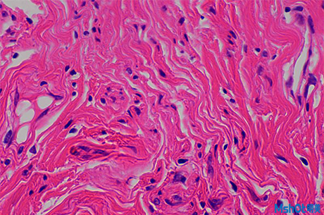 明美顯微鏡相機應用于肝切片觀察