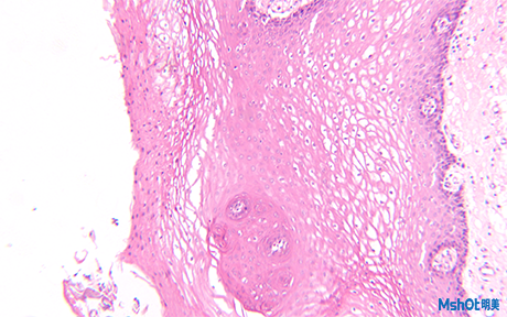 明美熒光顯微鏡助力北京大學深圳醫(yī)院活細胞熒光觀察