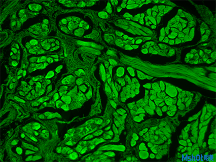 明美熒光顯微鏡助力北京大學深圳醫(yī)院熒光細胞觀察