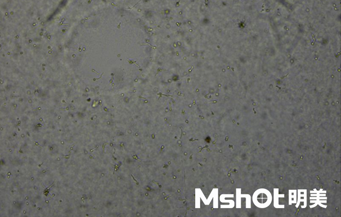 米曲霉用什么顯微鏡看？