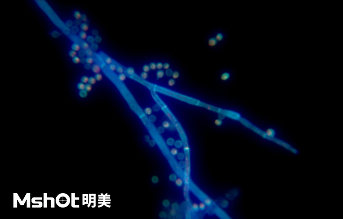 熒光生物顯微鏡下的黃曲霉？