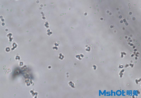 國產(chǎn)生物顯微鏡搭配顯微鏡相機觀察到乳酸菌
