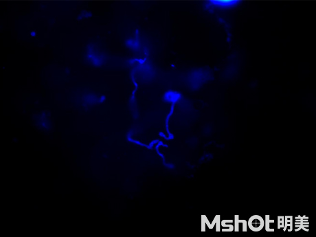 熒光生物顯微鏡應(yīng)用于醫(yī)院皮膚真菌檢查