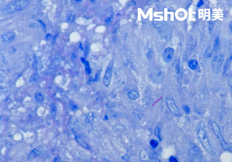 國產(chǎn)顯微鏡應(yīng)用于結(jié)核桿菌檢測