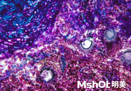 國(guó)產(chǎn)顯微鏡應(yīng)用于煙曲霉檢測(cè)