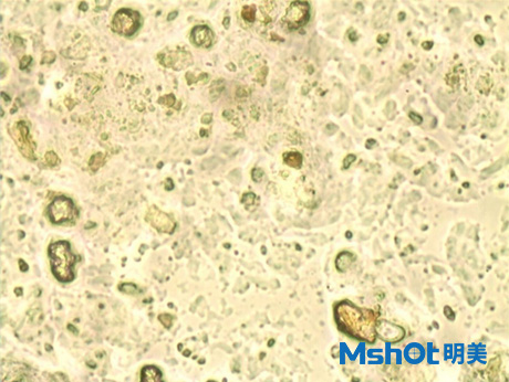 巧克力在顯微鏡下長什么樣子？