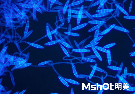 真菌檢測(cè)一般配備什么顯微鏡？