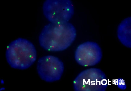 明美顯微鏡應用于病理切片檢查