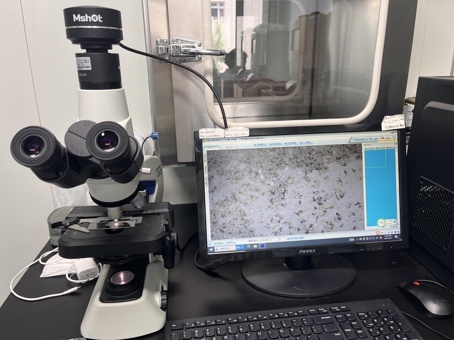 顯微鏡下的痰液檢查|應用百科