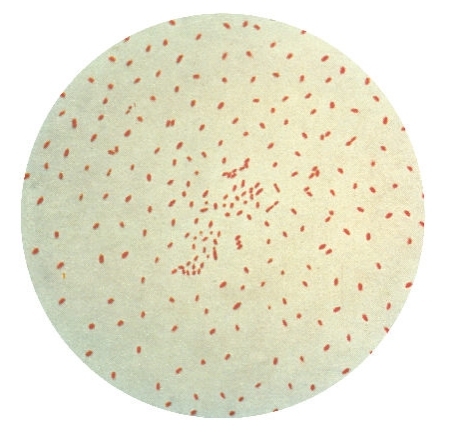 如何檢測百日咳？顯微鏡是種方法|應用百科