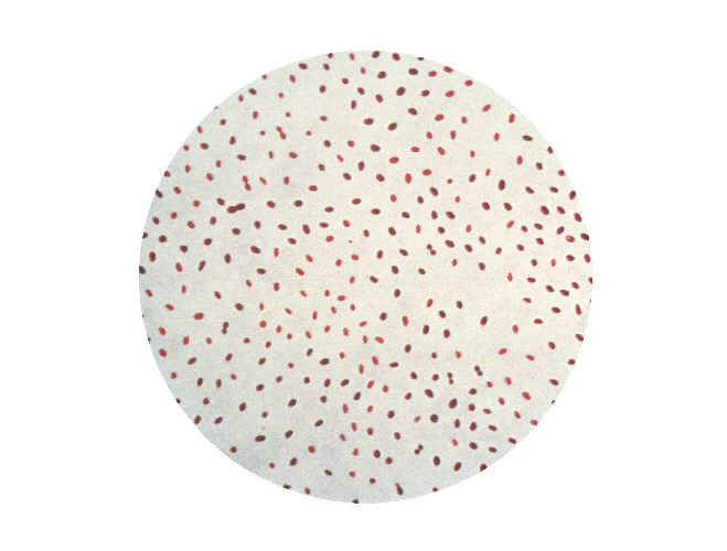 顯微鏡下的布魯氏桿菌|應用百科