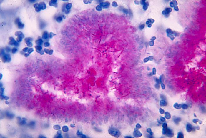 顯微鏡下的諾卡菌|應用百科