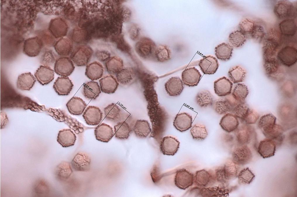 顯微鏡下的黏菌|應用百科