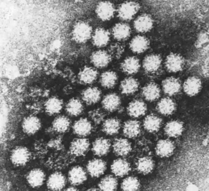 顯微鏡應用于諾如病毒研究|應用百科