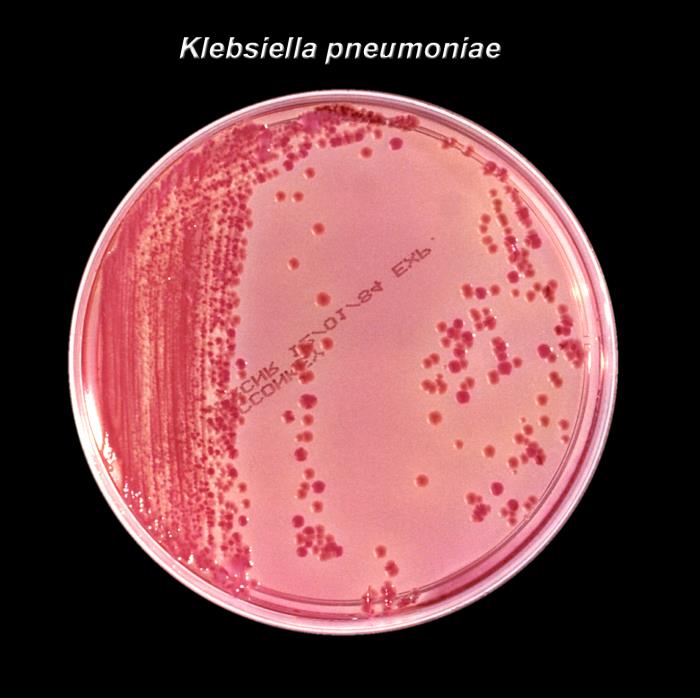 顯微鏡下的克雷伯氏菌|應用百科