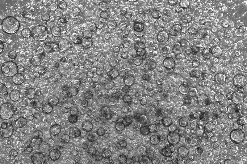 活細(xì)胞掃描分析儀拍攝圖