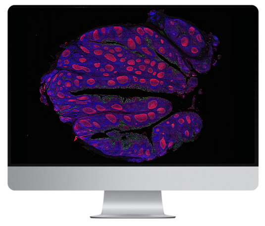 多重?zé)晒鈹?shù)字切片掃描系統(tǒng)