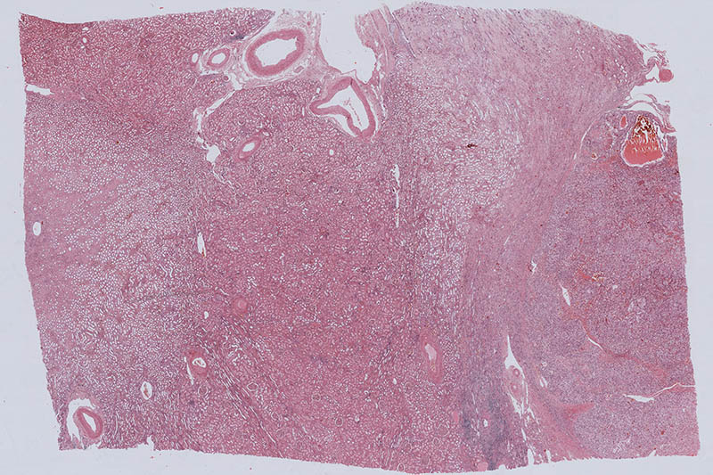 多重?zé)晒鈹?shù)字切片掃描系統(tǒng)拍攝圖