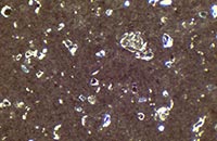 ��ճ��Ĕz�D�@΢�DƬ