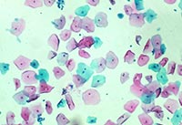 Һ����Ƭ�@΢�DƬ