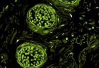 �{ɫ�ɹ�ģ�K�Ĕz�ğɹ��@΢�DƬ